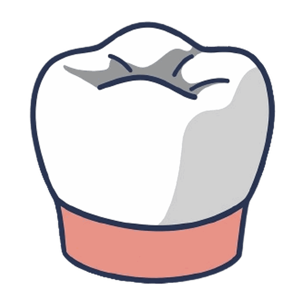 歯の詰め物・被せ物のイラスト素材