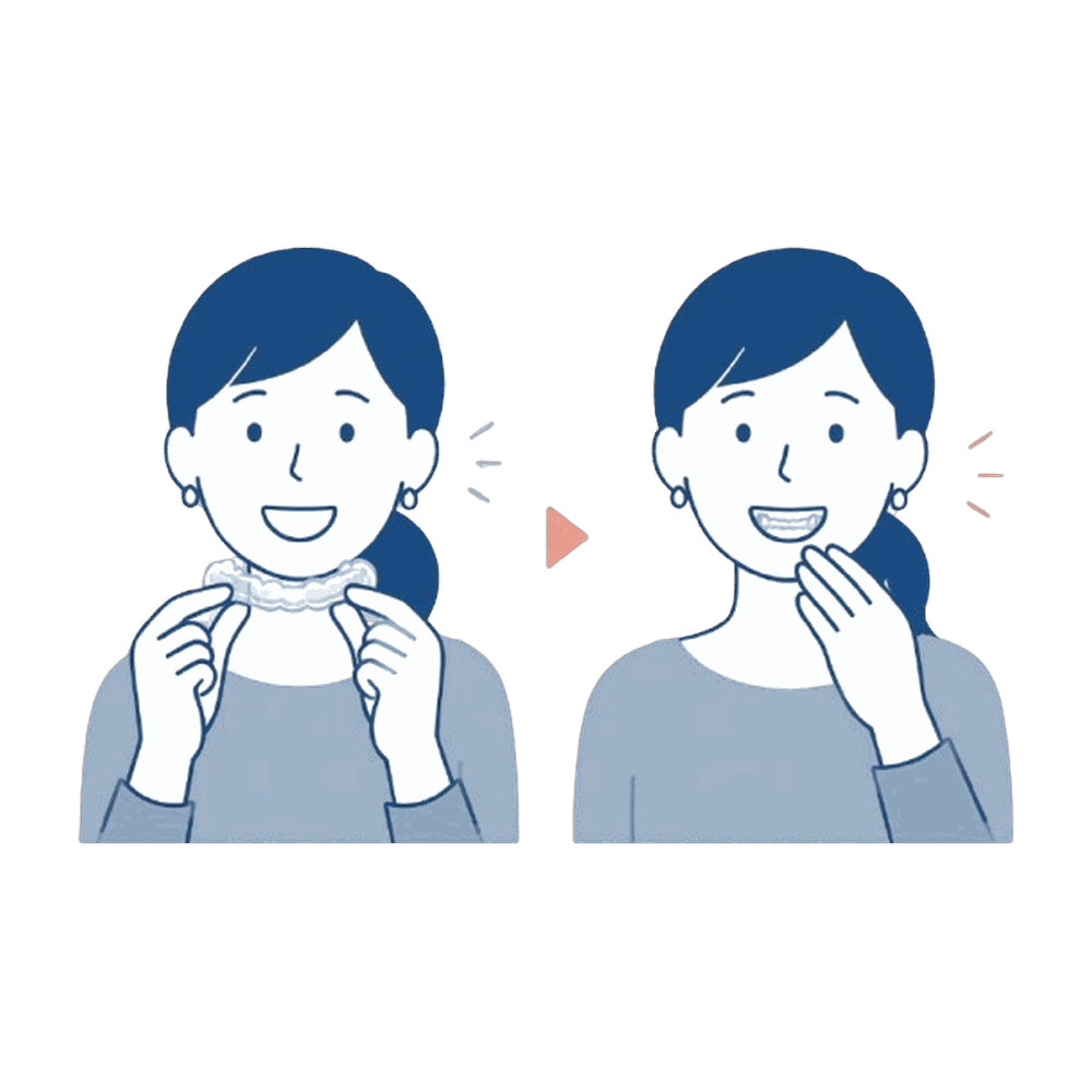 マウスピースを装着する女性(リテーナー)のイラスト素材