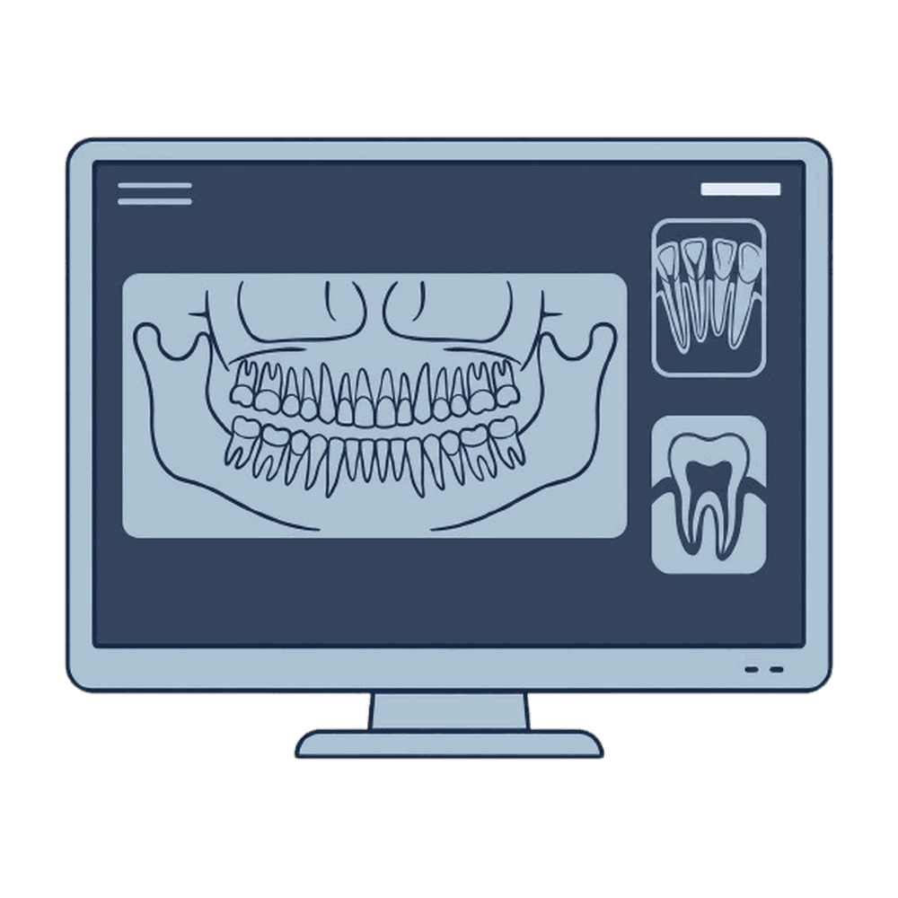 モニターに表示したパノラマX線のイラスト素材
