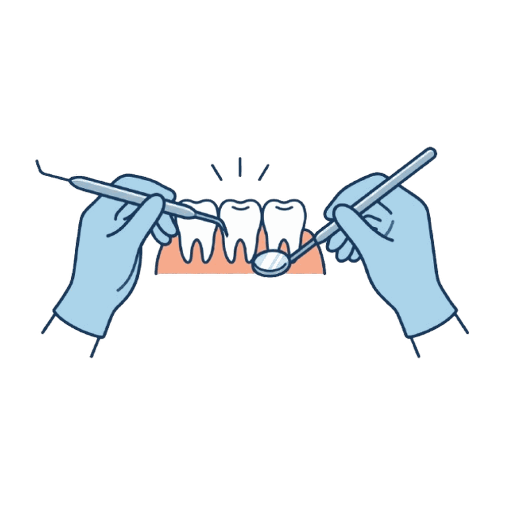 器具で歯を処置する手元のイラスト素材