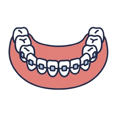 ワイヤー矯正（ブラケット）の歯列のイラスト素材