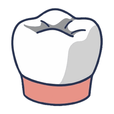歯の詰め物・被せ物のイラスト素材