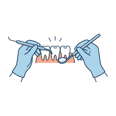 器具で歯を処置する手元のイラスト素材